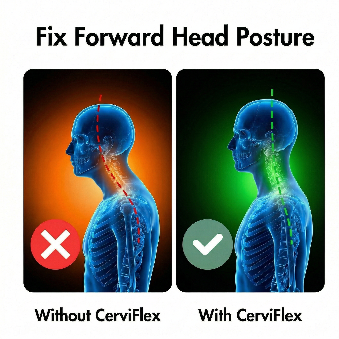 CerviFlex